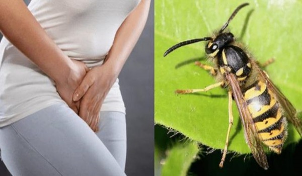 Doctors Are Warning Women Not To Put Wasp Nests Into Their Private Parts Healthy Food Advice