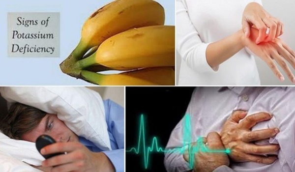 9 Symptoms Of Low Potassium Levels In Your Body That You Should Not Ignore Healthy Food Advice